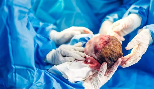 Birth Injury